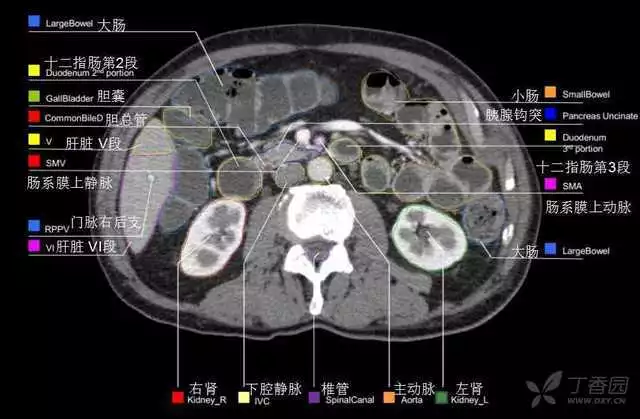 掌握这篇解剖，晋级腹部CT影像诊断高手（精细版）