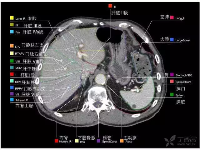 掌握这篇解剖，晋级腹部CT影像诊断高手（精细版）