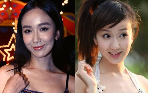 脸僵如石！明知“硅胶脸”恐怖，为何还有女星