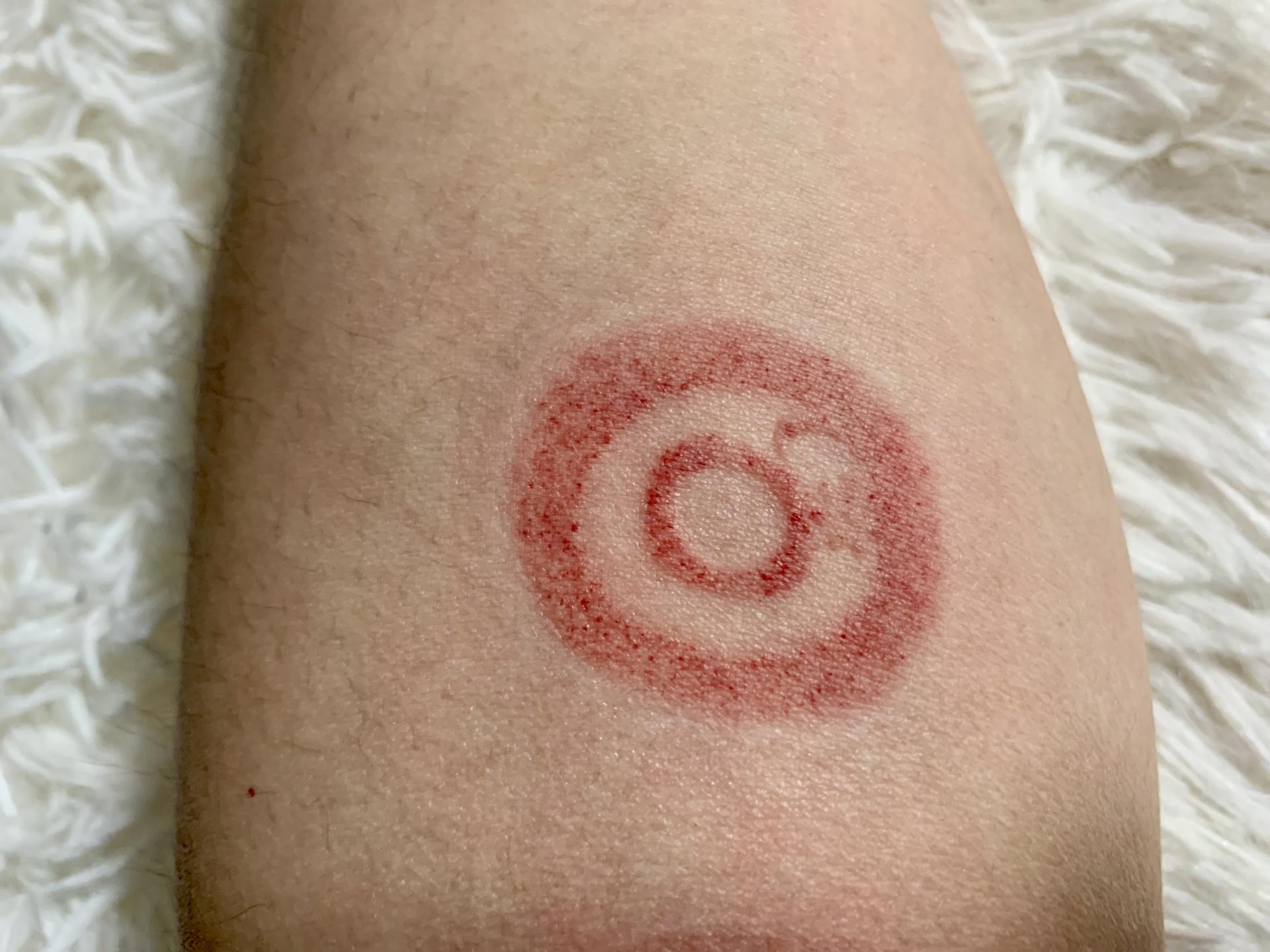 走罐智能化是怎样的体验？左点智能走罐按摩器上手，开启智能养生