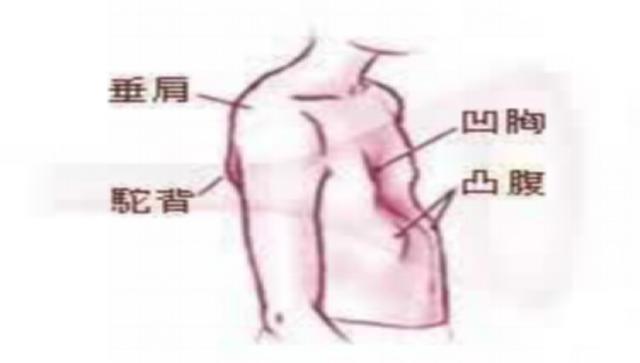 维生素D3的正确用法用量及其在人体中发挥的重要作用