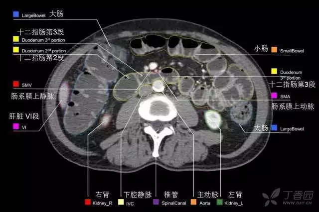 掌握这篇解剖，晋级腹部CT影像诊断高手（精细版）