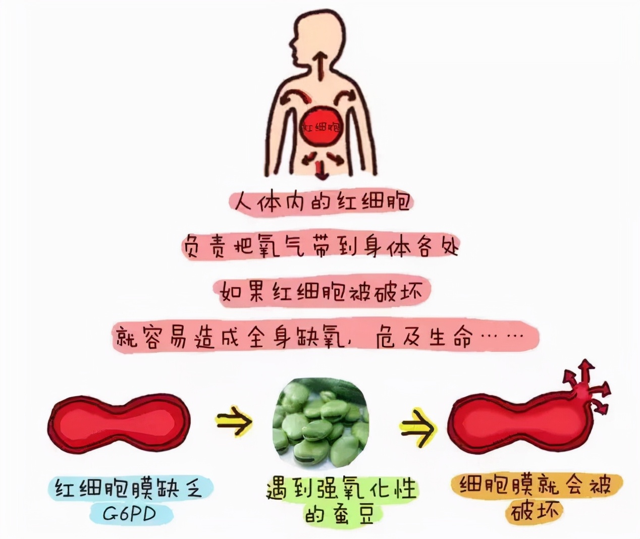 蠶豆症 G6pd缺乏症 有何症狀及禁忌 主因是遺傳 Bowtie