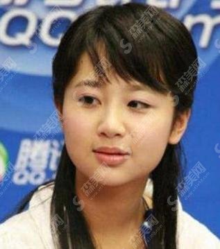 Yang Zi got plastic surgery?Does Yang Zi's beauty have something to do ...