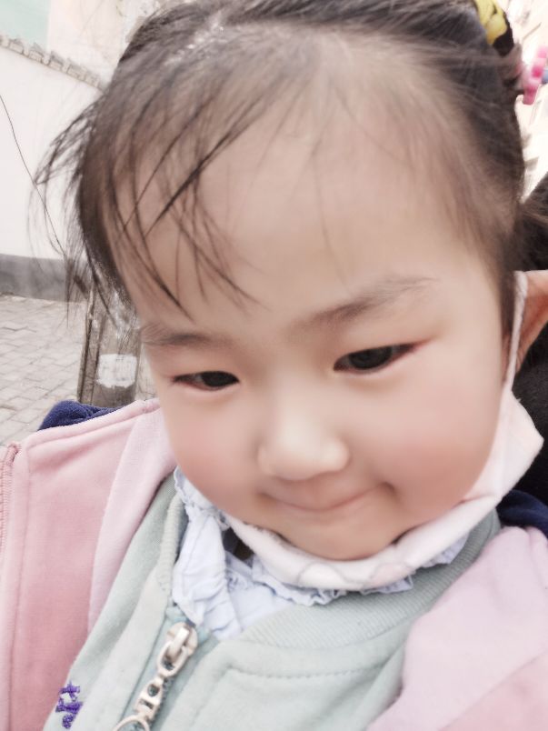 盐酸西替利嗪糖浆缓解了孩子脸红瘙痒症状