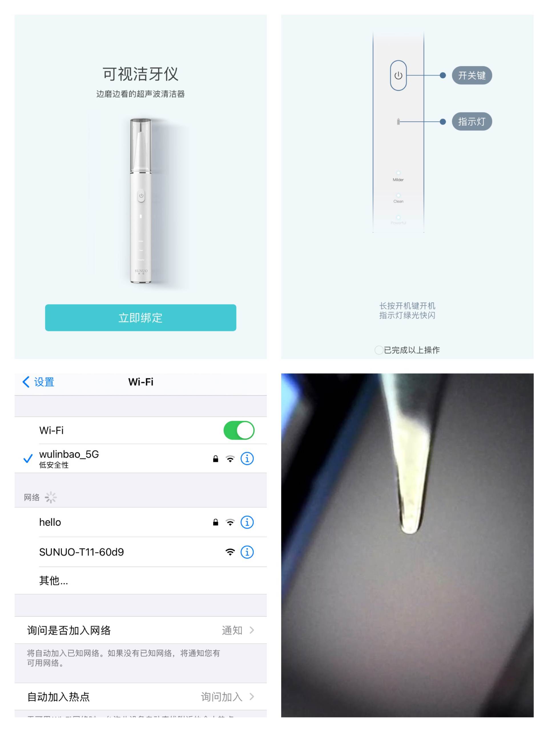 谁说牙齿不能做SPA-素诺智能可视超声波洁牙仪体验