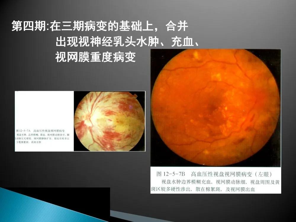 健康科普大赛获奖作品展示⑤|老年人常见眼部不适