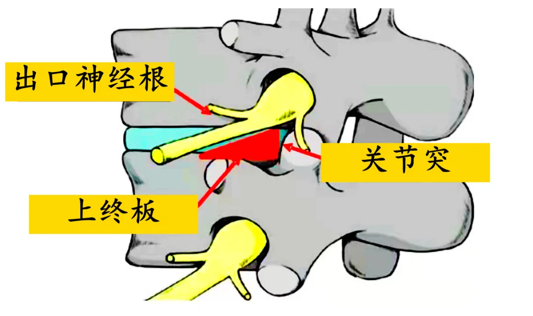 脊柱科普|选择性神经根阻滞"一箭双雕"→诊断 治疗