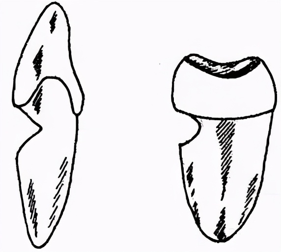 牙齿会越刷越糟吗？专家提醒：学习正确的刷牙方法更重要