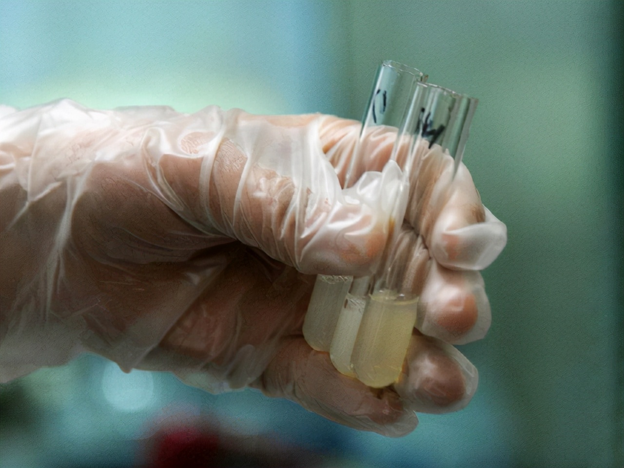 Approximately how many times can a man ejaculate in his lifetime?These