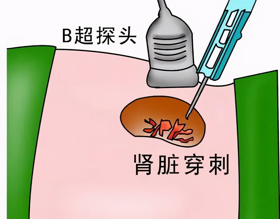 ̻죬ҽԺʾ