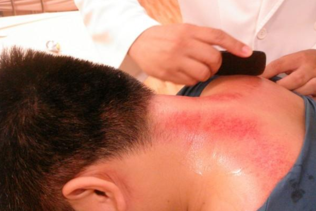 經絡不通百病生，你的經絡還暢通嗎？ 快來自檢