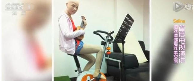 Selina坎坷的经历：29岁全身54%被烧伤，35岁离婚，38岁嗓子失声