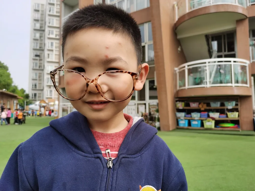 眼睛的秘密——四川天府新区华阳幼儿园南区小一班安全主题活动