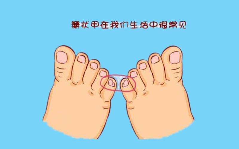 小脚趾头上有2片指甲 会不会预示着什么疾病 资讯咖