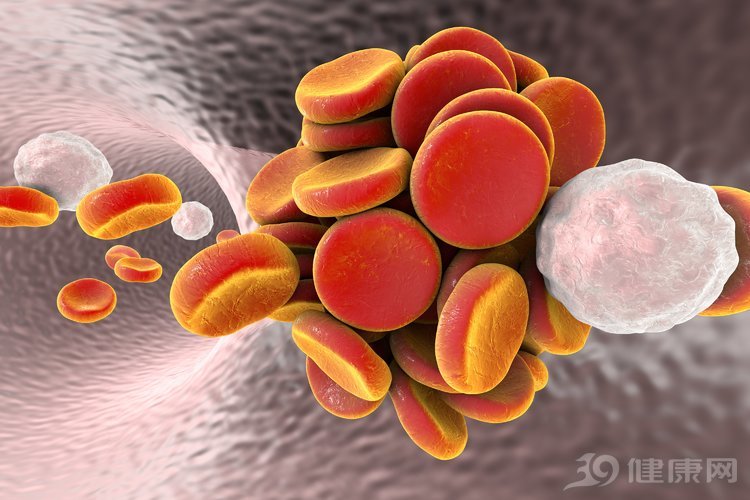 高血壓患者3種食物長期吃，可以改善血管硬化，血管暢通血壓降