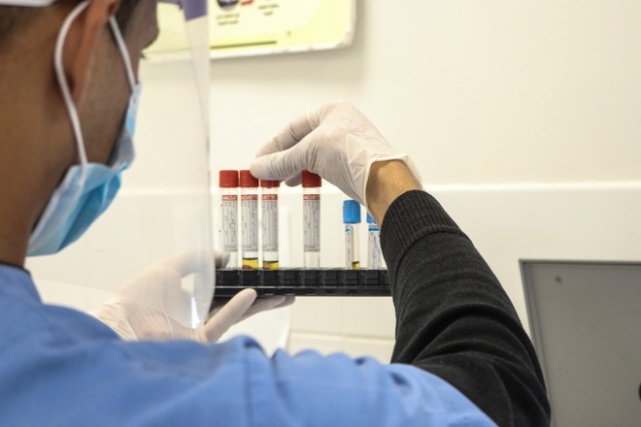 英國新冠病毒突變體來源確定，或與英國無關，今年4月就已發現