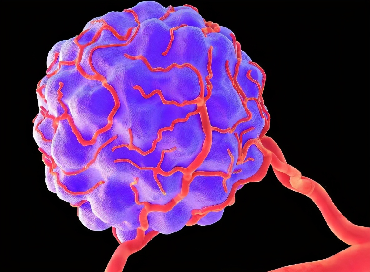 肿瘤，可以培养的比恐龙还大吗？