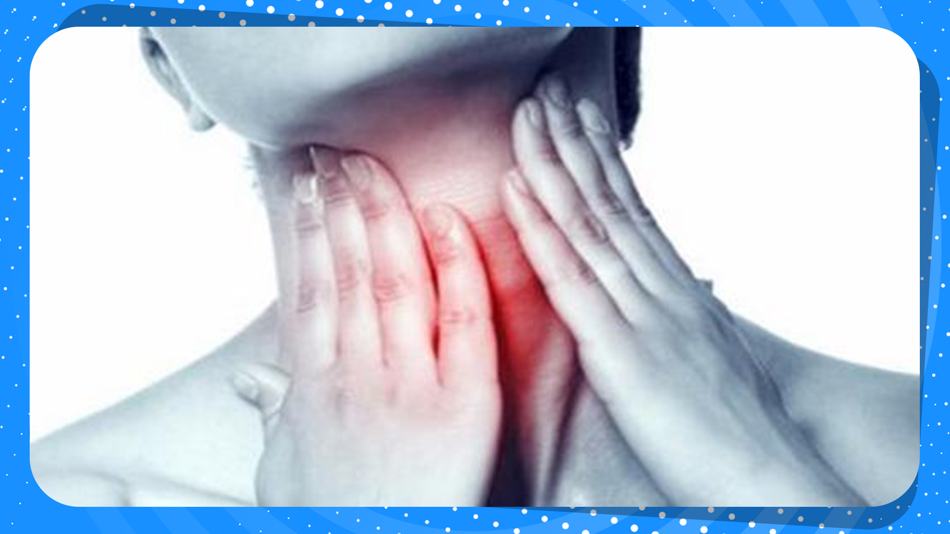 Swelling and sore throat, dry throat, Chinese medicine these