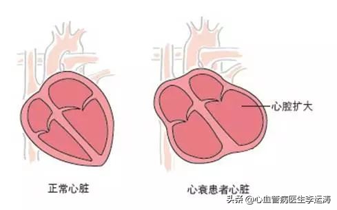 BNP和NT-proBNP是什么？为什么可以用来诊断心衰？