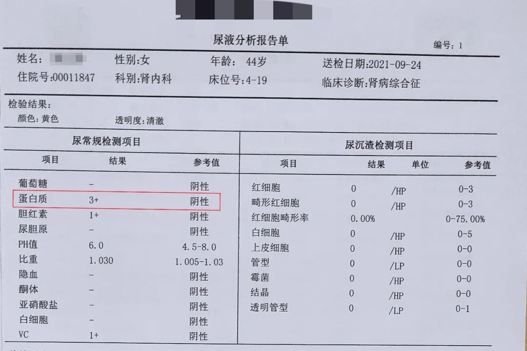 Is urine protein 1+ serious?What are the consequences of longterm