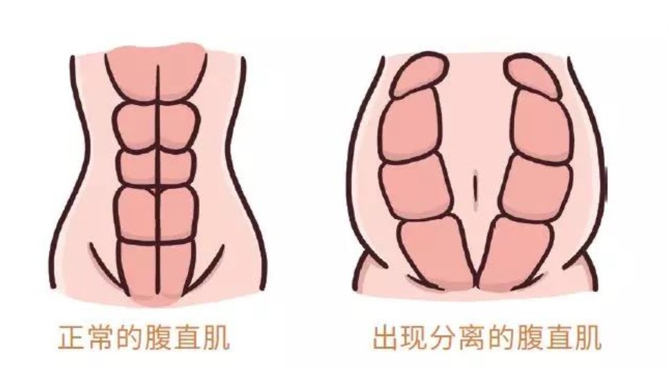 “卑微丹”不见了？朱丹产后大方晒身材，笑称