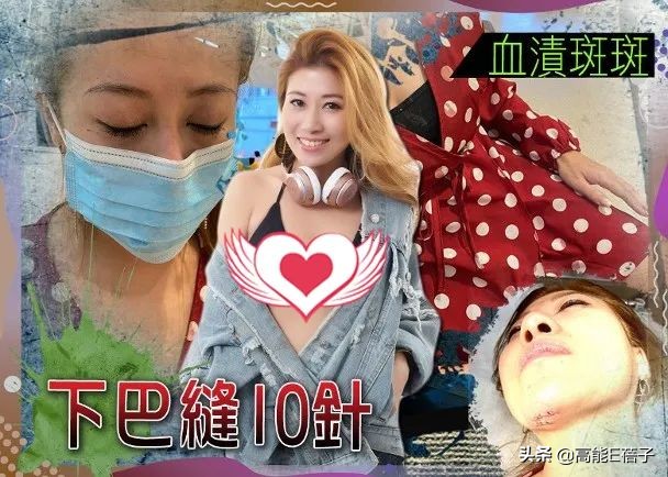 38岁香港女歌手被陌生外国女子三连踢破相，此前