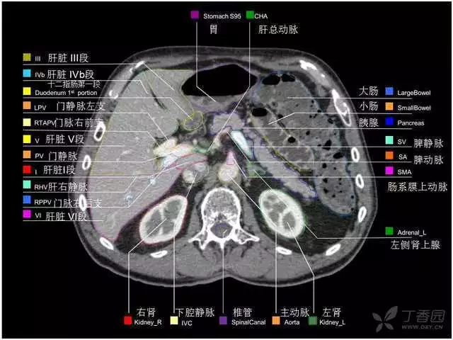 掌握这篇解剖，晋级腹部CT影像诊断高手（精细版）