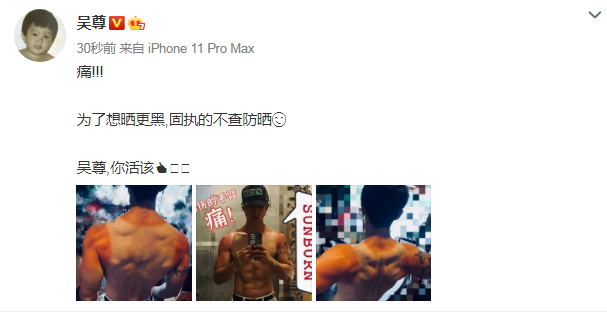 吳尊自曝想曬更黑不擦防曬，身體大片曬傷像塗了層醬油，看著都疼