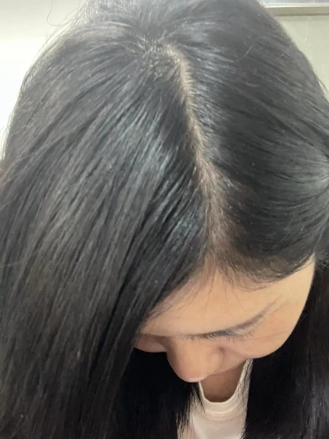 How does gray hair turn black?Share my personal experience iNEWS