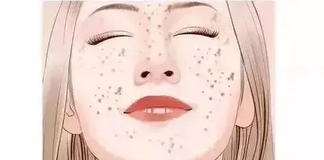 「唯诺雅淡斑反馈」秋季是祛斑的黄金周期