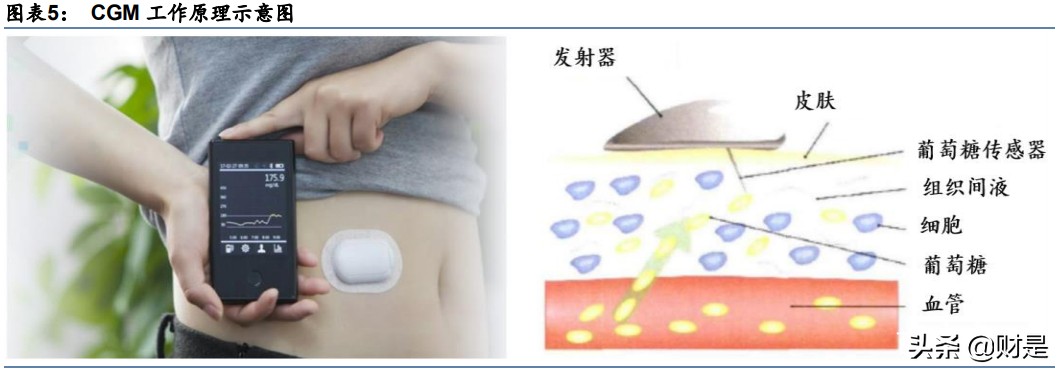 血糖监测行业研究：CGM，明日之星，未来可期