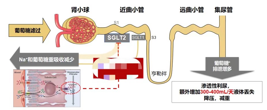 达格列净降糖效果真的不错，为什么医生不愿给女性病人使用？