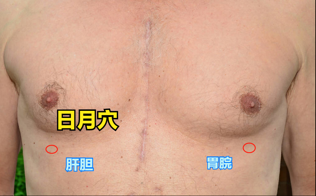 往來寒熱、胸脅苦滿，中藥是用小柴胡湯；那穴位呢？ 醫生為您解讀