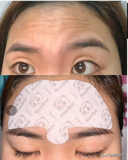 眉间出现“三杠纹”代表着什么？男人女人都应该来看一看