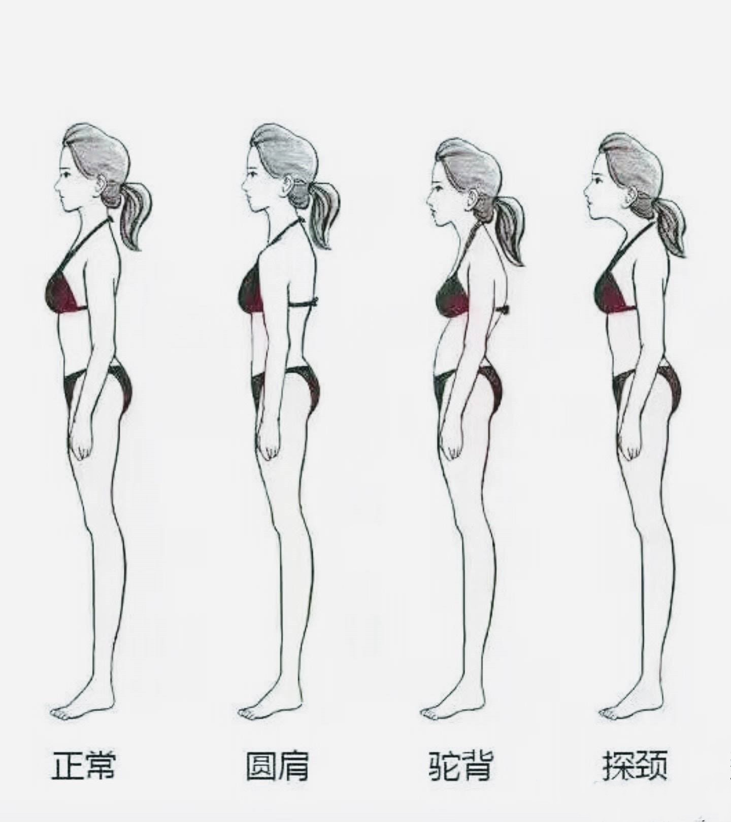 The round shoulders have so many influences!3 reasons cause round shoulders, use 3 methods to