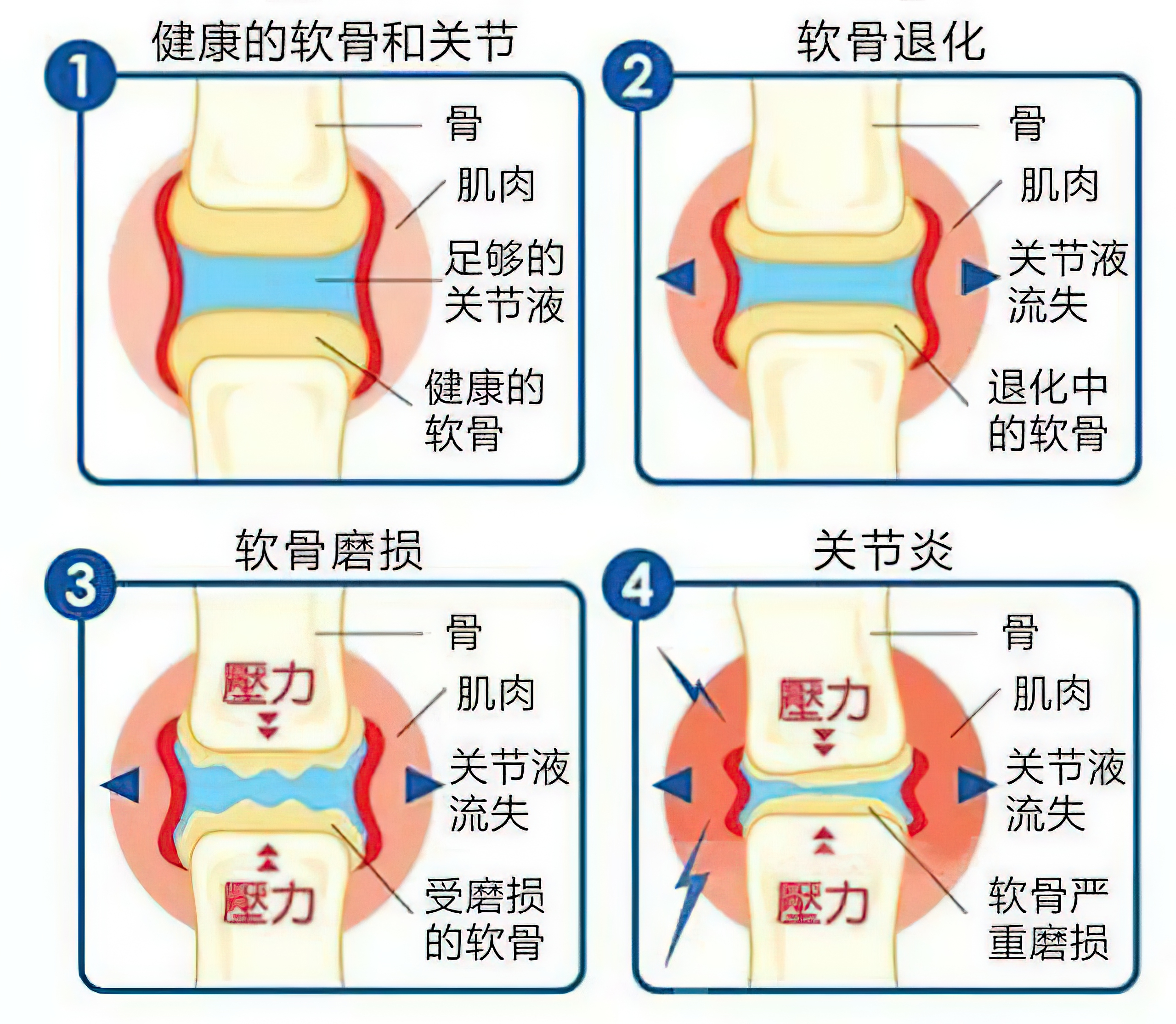 骨像应图的意思图片