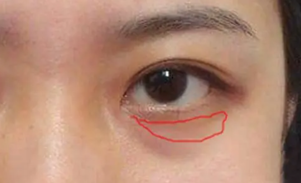 “眼霜”到底有沒有用？深扒它的謊言和真相