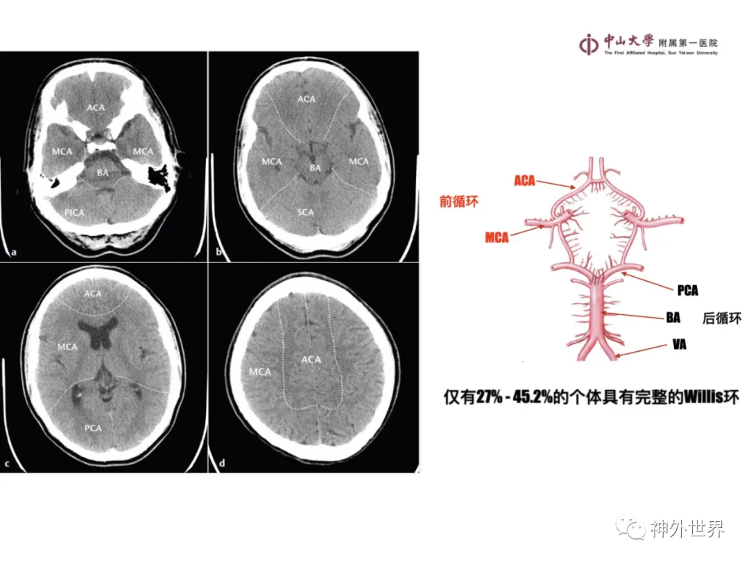 最全影像总结 | 颅内病变 MR、CT 的阅片技巧，太赞了