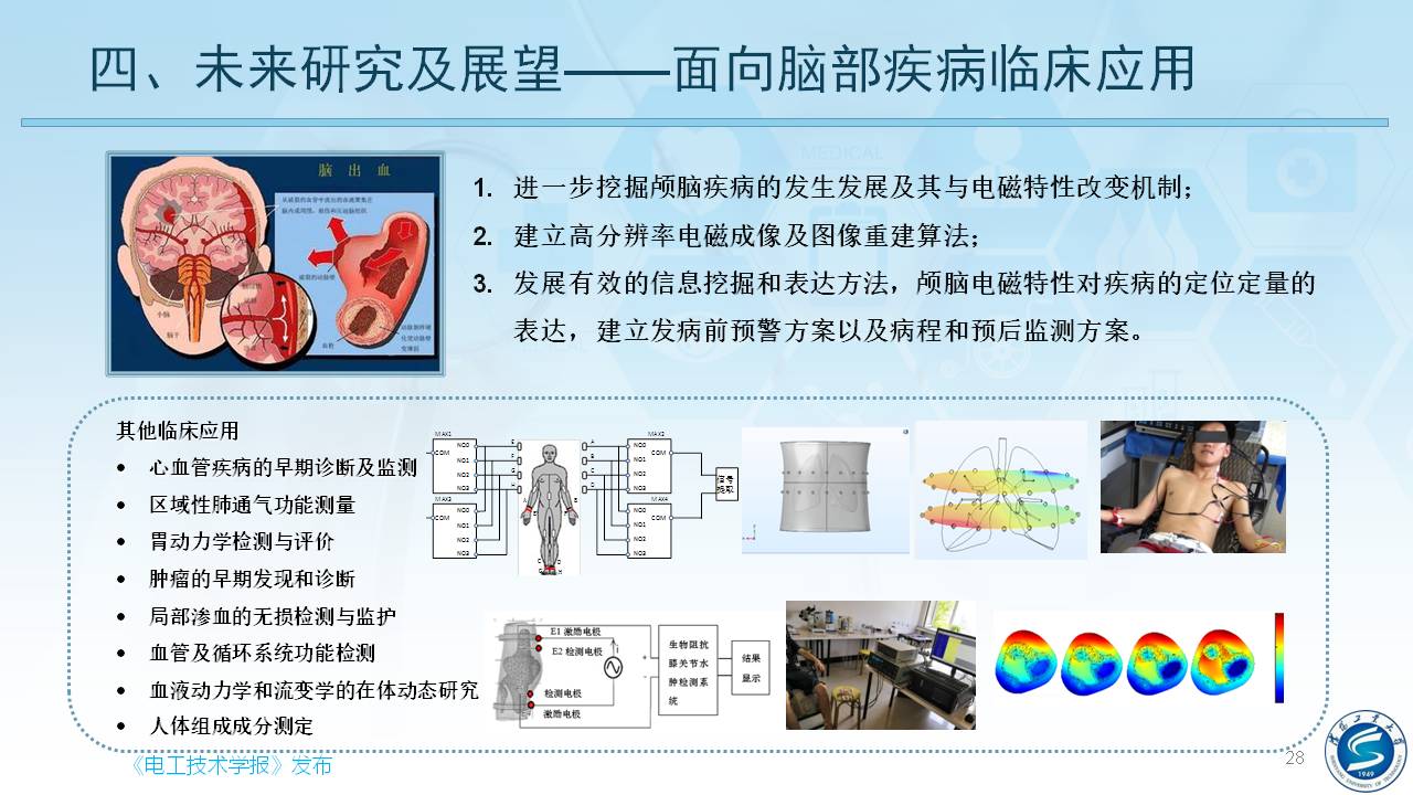 沈陽工業(yè)大學(xué)柯麗教授：感應(yīng)式顱腦電磁特性檢測與成像方法研究