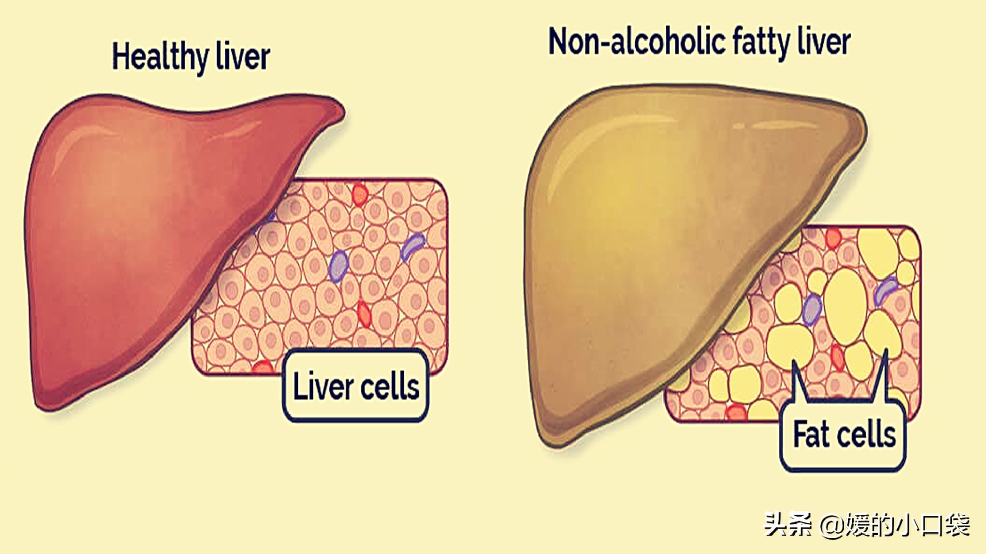 Nutritionist New research says that two types of beverages can harm