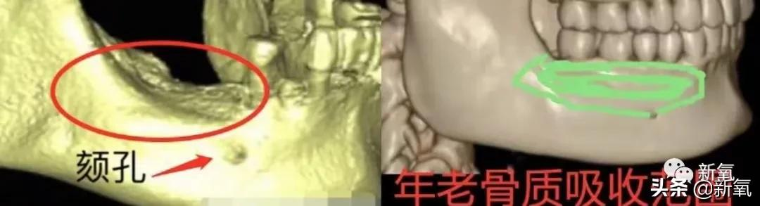 为什么蔡少芬身上的美人感逐渐消失了?