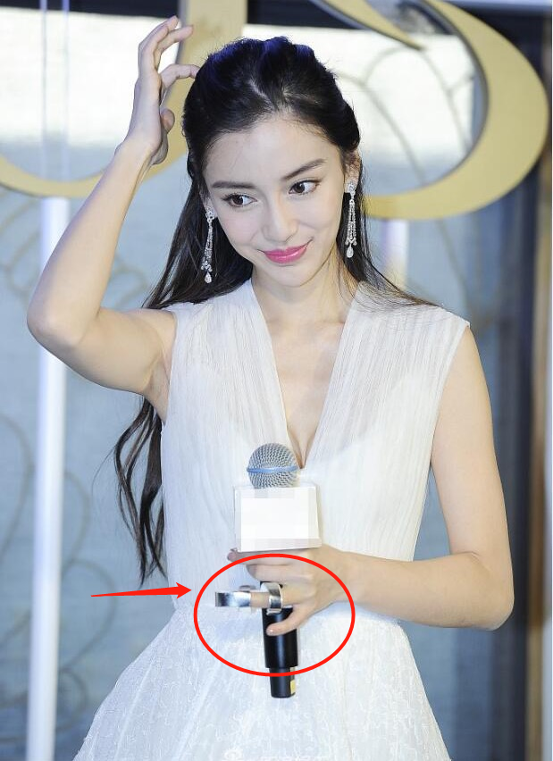 明星录综艺有多危险？邓超打石膏、baby骨折，最