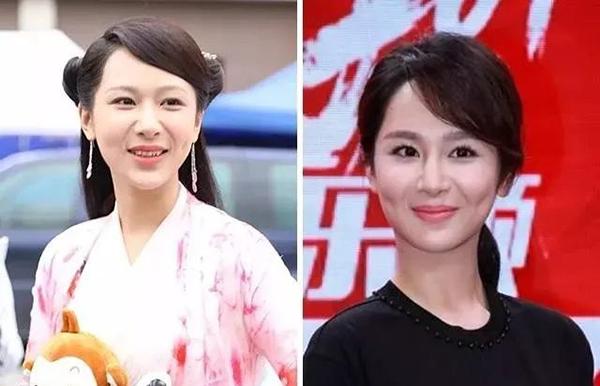 明星也有颜值缺陷，杨紫和郑爽法令纹深，鹿晗