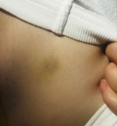 被“宝马男”殴打的女子发声：宝马是我的，之