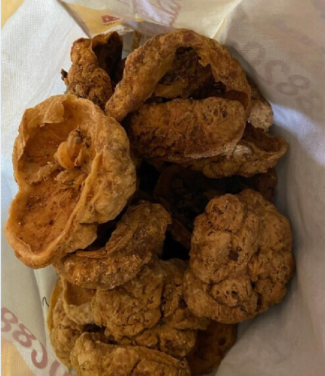 从医废厂、殡仪馆收货？被国人追捧的胎盘，实则只是带血的垃圾