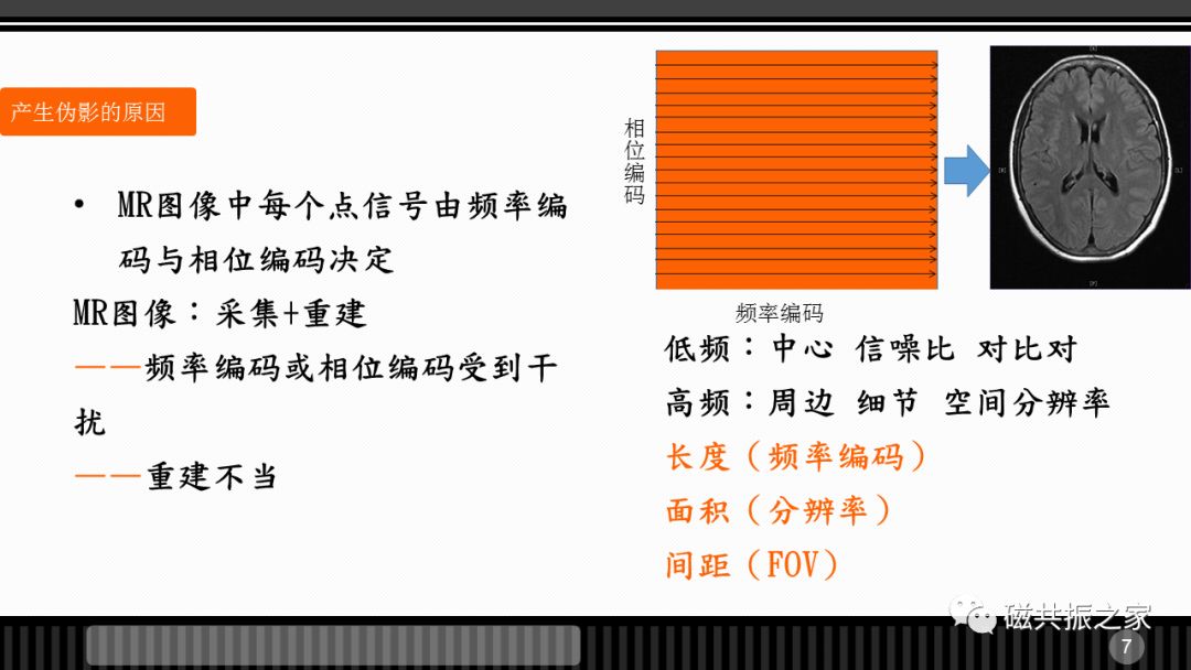 磁共振常见伪影及策略