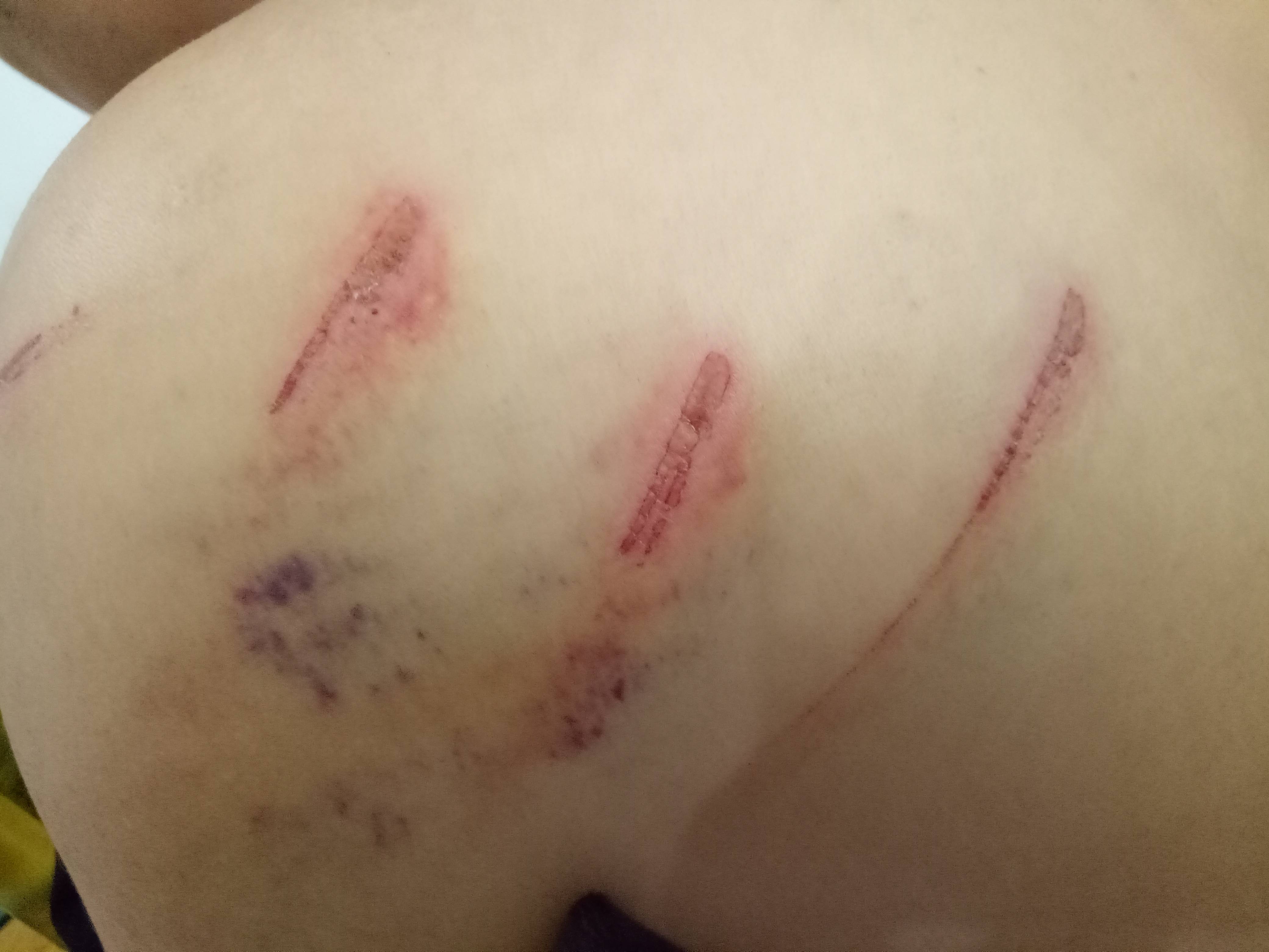 湖南女子五次起诉离婚:家人被殴打恐吓 怕报复床头藏刀