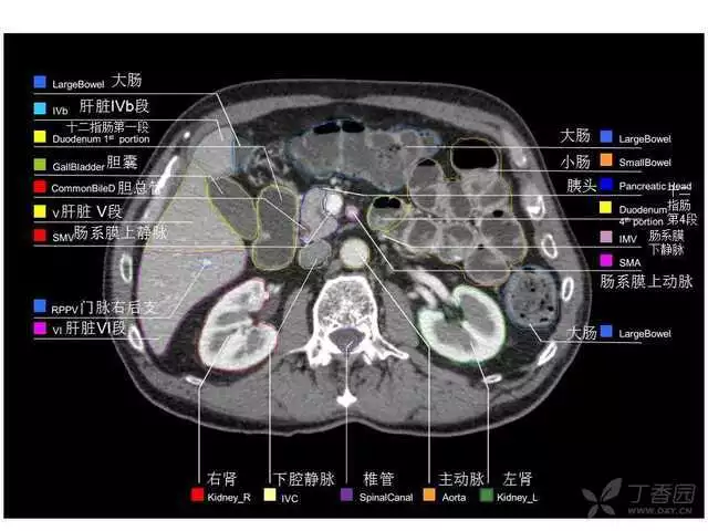 掌握这篇解剖，晋级腹部CT影像诊断高手（精细版）