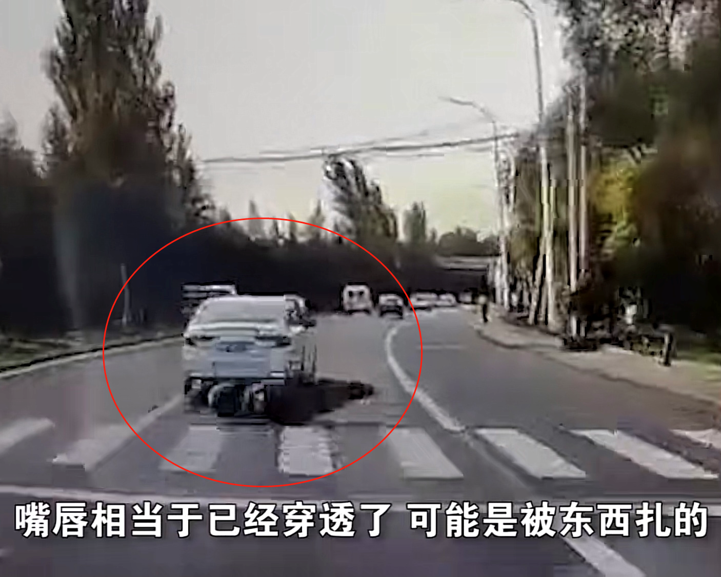 北京一轿车恶意别倒摩托车，女骑手倒地翻滚多圈受伤，知情人：嫌她慢